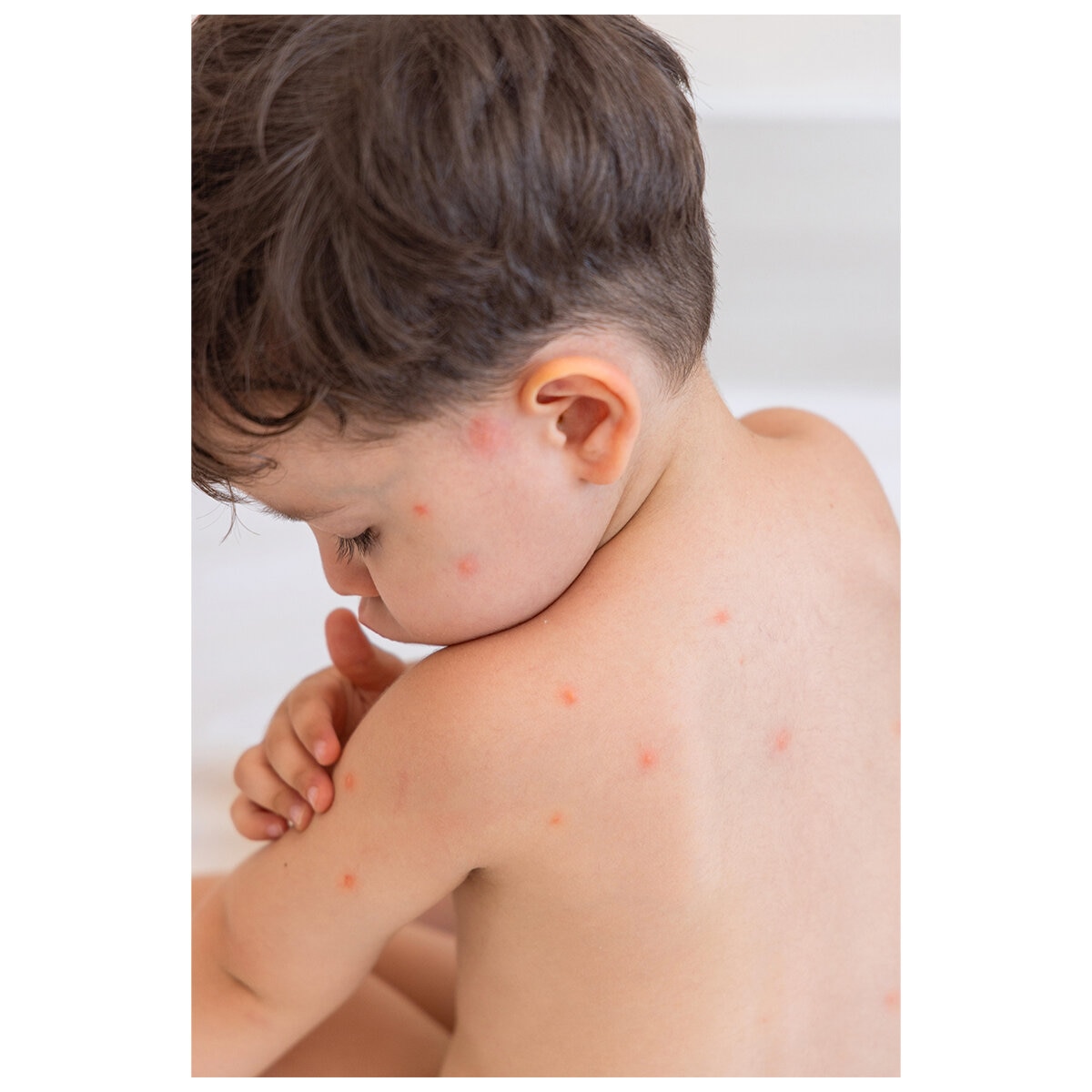 Itchfix Soothing Gel 2 x 75g