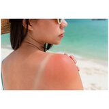 Itchfix Soothing Gel 2 x 75g