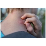 Itchfix Soothing Gel 2 x 75g